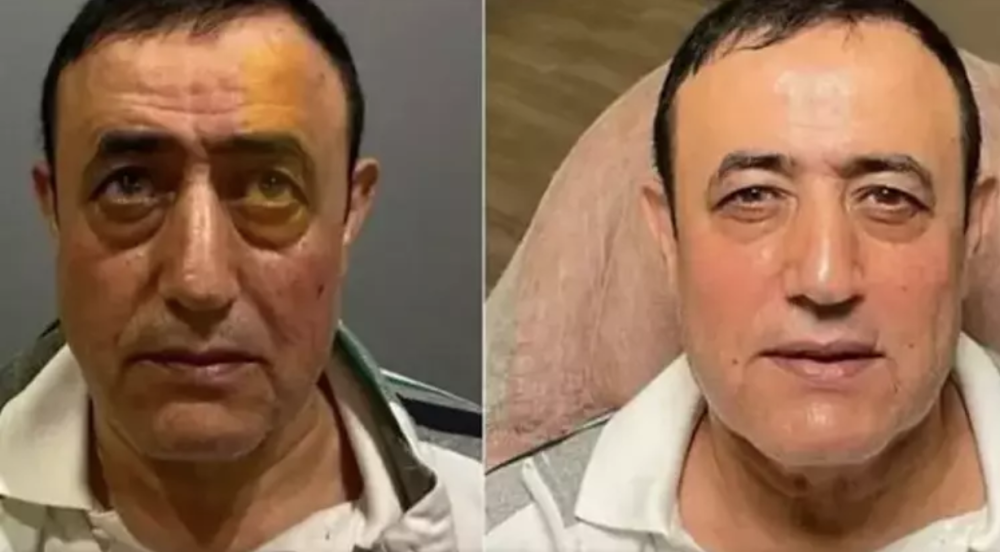 estetik yaptiran mahmut tuncer den dikkat ceken aciklama ivana gelecegi gormus